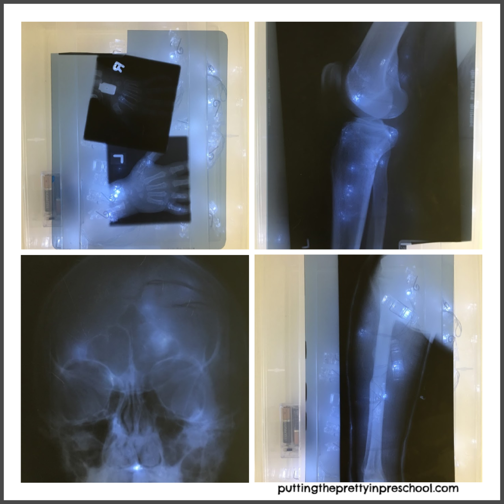 View x-rays on a lid covered, clear plastic tub with led lights inside.